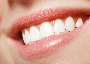 Close-up of smile showing off teeth