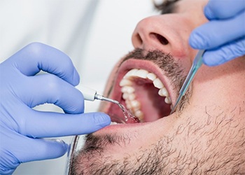 man getting dental cleaning