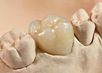 Model smile with dental crown restoration