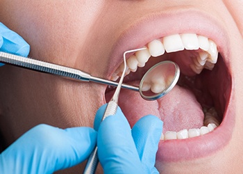 Closeup of mouth being examined by dental instruments held by hands with blue gloves