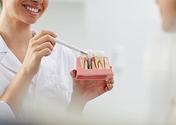 dentist holding a model of a dental implant in the jaw 