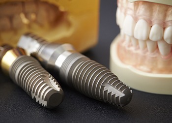 Model smile and dental implant posts