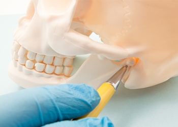 Model of jaw and skull bone