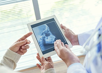 X-ray of jaw and skull bone on tablet computer